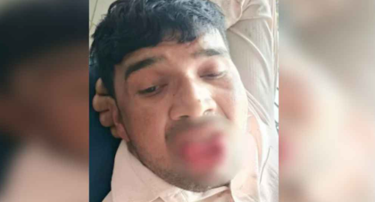অন্তরঙ্গ মুহুর্তে যে কাণ্ড ঘটালেন প্রেমিকা