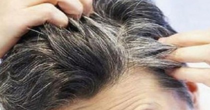 যেসব কারণে অল্প বয়সে চুল পেকে যায়!
